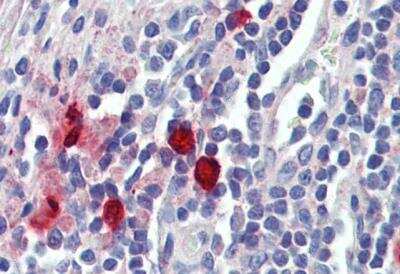 Immunohistochemistry-Paraffin: Chymase/CMA1/Mast Cell Chymase Antibody [NBP2-27551] - Staining of paraffin embedded Human Tonsil (Mast cells). Antibody at 1.5 ug/mL. Steamed antigen retrieval with citrate buffer pH 6, AP-staining.