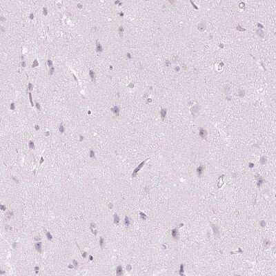 Immunohistochemistry-Paraffin: Chymase/CMA1/Mast Cell Chymase Antibody [NBP2-33660] - Staining of human cerebral cortex shows no positivity in neurons as expected.