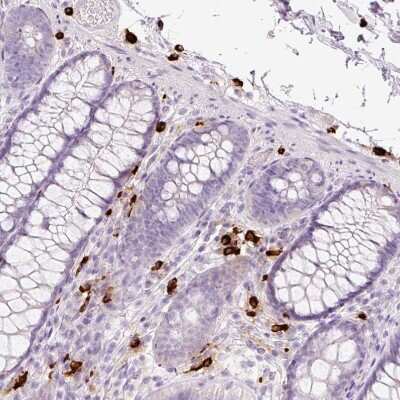 Immunohistochemistry-Paraffin: Chymase/CMA1/Mast Cell Chymase Antibody [NBP2-33660] - Staining of human colon shows strong cytoplasmic positivity in mast cell.