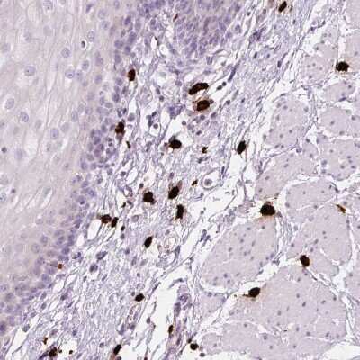 Immunohistochemistry-Paraffin: Chymase/CMA1/Mast Cell Chymase Antibody [NBP2-33660] - Staining of human esophagus shows strong cytoplasmic positivity in mast cell.