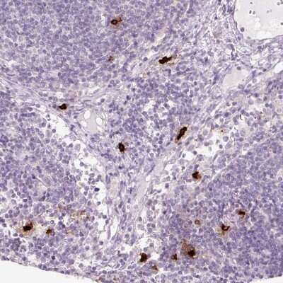 Immunohistochemistry-Paraffin: Chymase/CMA1/Mast Cell Chymase Antibody [NBP2-33660] - Staining of human lymph node shows strong cytoplasmic positivity in mast cell.