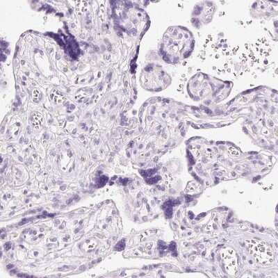 Immunohistochemistry-Paraffin: Chymase/CMA1/Mast Cell Chymase Antibody [NBP2-33660] - Staining of human placenta shows no positivity in trophoblastic cells as expected.