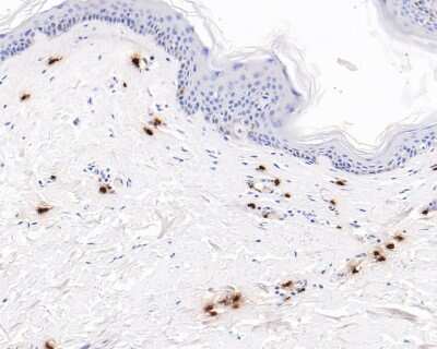 Immunohistochemistry-Paraffin: Chymase/CMA1/Mast Cell Chymase Antibody (JB74-32) [NBP2-75441] - Analysis of paraffin-embedded human skin tissue using anti-Mast Cell Chymase antibody. The section was pre-treated using heat mediated antigen retrieval with Tris-EDTA buffer (pH 8.0-8.4) for 20 minutes.The tissues were blocked in 5% BSA for 30 minutes at room temperature, washed with ddH2O and PBS, and then probed with the primary antibody (1/50) for 30 minutes at room temperature. The detection was performed using an HRP conjugated compact polymer system. DAB was used as the chromogen. Tissues were counterstained with hematoxylin and mounted with DPX.