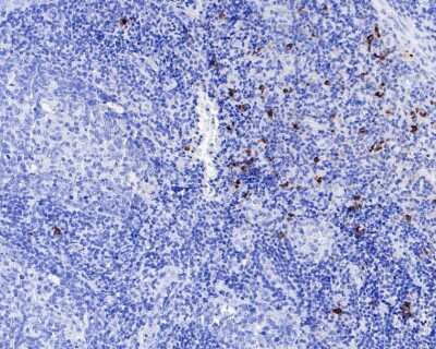 Immunohistochemistry-Paraffin: Chymase/CMA1/Mast Cell Chymase Antibody (JB74-32) [NBP2-75441] - Analysis of paraffin-embedded human tonsil tissue using anti-Mast Cell Chymase antibody. The section was pre-treated using heat mediated antigen retrieval with Tris-EDTA buffer (pH 8.0-8.4) for 20 minutes.The tissues were blocked in 5% BSA for 30 minutes at room temperature, washed with ddH2O and PBS, and then probed with the primary antibody (1/50) for 30 minutes at room temperature. The detection was performed using an HRP conjugated compact polymer system. DAB was used as the chromogen. Tissues were counterstained with hematoxylin and mounted with DPX.