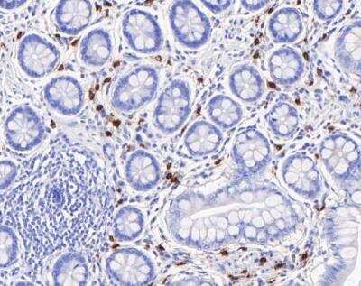 Immunohistochemistry-Paraffin: Chymase/CMA1/Mast Cell Chymase Antibody (JB74-32) [NBP2-75441] - Human small intestine tissue using anti-Mast Cell Chymase antibody. The section was pre-treated using heat mediated antigen retrieval with Tris-EDTA buffer (pH 8.0-8.4) for 20 minutes.The tissues were blocked in 5% BSA for 30 minutes at room temperature, washed with ddH2O and PBS, and then probed with the primary antibody (1/200) for 30 minutes at room temperature. The detection was performed using an HRP conjugated compact polymer system. DAB was used as the chromogen. Tissues were counterstained with hematoxylin and mounted with DPX.