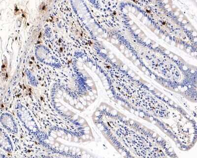 Immunohistochemistry-Paraffin: Chymase/CMA1/Mast Cell Chymase Antibody (JB74-32) [NBP2-75441] - Analysis of paraffin-embedded human small intestine tissue with Rabbit anti-Chymase/CMA1/Mast Cell Chymase antibody washed with ddH2O and PBS, and then probed with the primary antibody at 1/800 dilution for 1 hour at room temperature. The detection was performed using an HRP conjugated compact polymer system. DAB was used as the chromogen. Tissues were counterstained with hematoxylin and mounted with DPX.