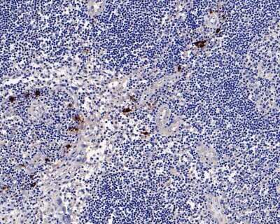 Immunohistochemistry-Paraffin: Chymase/CMA1/Mast Cell Chymase Antibody (JB74-32) [NBP2-75441] - Analysis of paraffin-embedded human lymph nodes tissue with Rabbit anti-Chymase/CMA1/Mast Cell Chymase antibody washed with ddH2O and PBS, and then probed with the primary antibody  at 1/800 dilution for 1 hour at room temperature. The detection was performed using an HRP conjugated compact polymer system. DAB was used as the chromogen. Tissues were counterstained with hematoxylin and mounted with DPX.