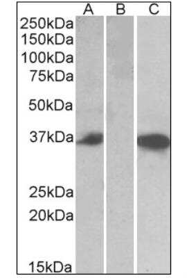 Western Blot: Chymase/CMA1/Mast Cell Chymase Antibody [NBP1-52386] - HEK293 lysate (10ug protein in RIPA buffer) over expressing Human CMA1 with DYKDDDDK tag probed with (0.5ug/ml) in Lane A and probed with anti- DYKDDDDK Tag (1/3000) in lane C. Mock-transfected HEK293 probed (1mg/ml) in Lane B. Primary