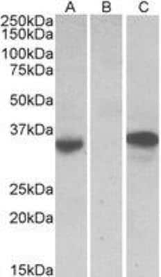 Western Blot: Chymase/CMA1/Mast Cell Chymase Antibody [NBP2-27551] - HEK293 lysate (10 ug protein in RIPA buffer) over expressing Human CMA1 with DYKDDDDK tag probed with NBP2-27551 (0.5 ug/mL) in Lane A and probed with anti-DYKDDDDK Tag (1:3000) in lane C. Mock-transfected HEK293 probed with NBP2-27551 (1 mg/mL) in Lane B. Primary incubations were for 1 hour. Detected by chemiluminescence.