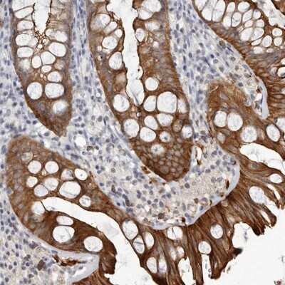 Immunohistochemistry-Paraffin: Cingulin Antibody [NBP1-89601] - Staining of human colon shows strong cytoplasmic and membranous positivity in glandular cells.