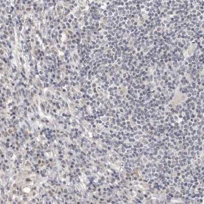 Immunohistochemistry-Paraffin: Cingulin Antibody [NBP1-89601] - Staining of human lymph node shows low expression as expected.