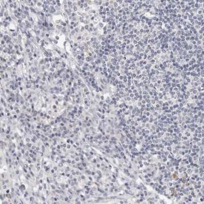 Immunohistochemistry-Paraffin: Cingulin Antibody [NBP1-89602] - Staining of human lymph node shows low expression as expected.