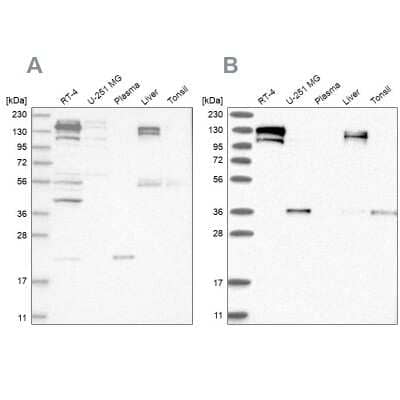 <b>Independent Antibodies Validation and Orthogonal Strategies Validation.</b>Western Blot: Cingulin Antibody [NBP1-89602] - Analysis using Anti-CGN antibody NBP1-89602 (A) shows similar pattern to independent antibody NBP1-89600 (B).