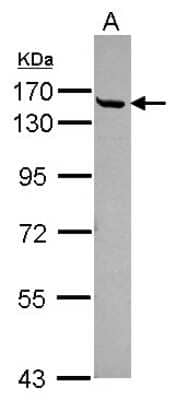 Western Blot: Cingulin Antibody [NBP2-15904] - Sample (30 ug of whole cell lysate) A: Juakat 7. 5% SDS PAGE gel, diluted at 1:500.