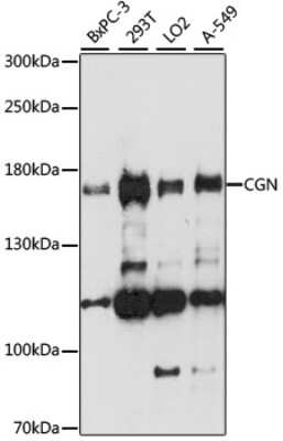 Western Blot: Cingulin Antibody [NBP2-92240] - Analysis of extracts of various cell lines, using Cingulin at 1:1000 dilution.Secondary antibody: HRP Goat Anti-Rabbit IgG (H+L) at 1:10000 dilution.Lysates/proteins: 25ug per lane.Blocking buffer: 3% nonfat dry milk in TBST.Detection: ECL Basic Kit .Exposure time: 90s.