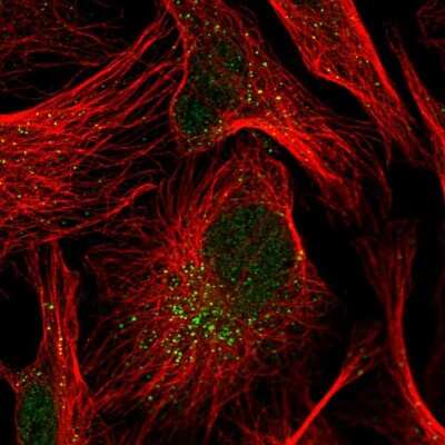 Immunocytochemistry/Immunofluorescence: Cip4 Antibody [NBP2-58988] - Staining of human cell line U-2 OS shows localization to nucleoplasm & vesicles.