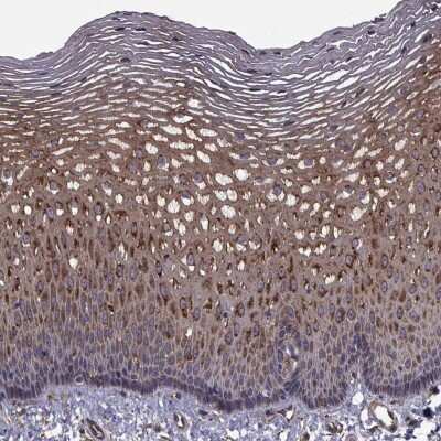 Immunohistochemistry: Cip4 Antibody [NBP2-68940] - Immunohistochemical staining of human esophagus shows strong cytoplasmic positivity in squamous epithelial cells.