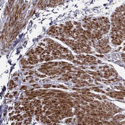 Immunohistochemistry: Cip4 Antibody [NBP2-68971] - Immunohistochemical staining of human smooth muscle shows strong cytoplasmic positivity in smooth muscle cells.