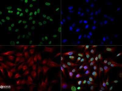 Immunocytochemistry/Immunofluorescence: Cited-2 Antibody (JA22) - Azide and BSA Free [NBP2-80671] - The Cited-2 (JA22) antibody was tested at a 1:250 dilution in HeLa cells against Dylight 488 (Green). Beta-tubulin and nuclei were counterstained against Dylight 550 (Red) and DAPI (Blue). Image from the standard format of this antibody.