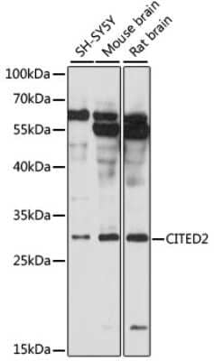 Western Blot: Cited-2 Antibody [NBP2-92090] - Analysis of extracts of various cell lines, using Cited-2 .Exposure time: 10s.