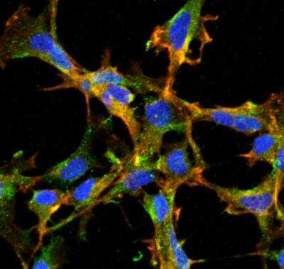 Immunocytochemistry/Immunofluorescence: Citrulline Antibody (2D3.1) [NBP2-59364] - Tissue: Embryonic kidney cells (HEK293). Species: Human. Fixation: 5% Formaldehyde for 5 min. Primary Antibody: Mouse Anti-Citrulline Monoclonal Antibody at 1:50 for 30-60 min at RT. Secondary Antibody: Goat Anti-Mouse Alexa Fluor 488 at 1:1500 for 30-60 min at RT. Counterstain: Phalloidin Alexa Fluor 633 F-Actin stain; DAPI (blue) nuclear stain at 1:250, 1:50000 for 30-60 min at RT. Magnification: 20X (2X Zoom).Courtesy of: Dr. Robert Burke, University of Victoria.