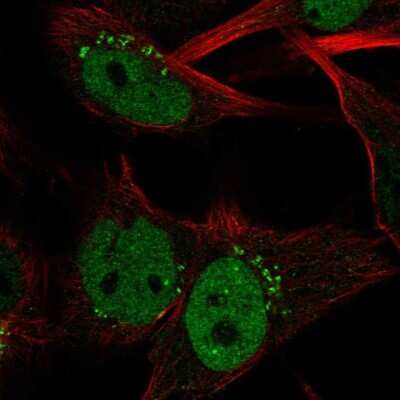 Immunocytochemistry/Immunofluorescence: Claspin Antibody [NBP2-55290] - Staining of human cell line U-251 MG shows localization to nucleoplasm & the Golgi apparatus.