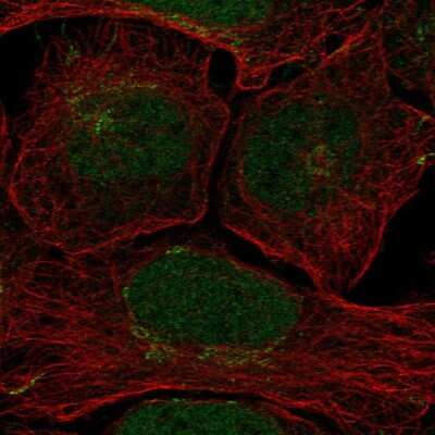Immunocytochemistry/Immunofluorescence: Claspin Antibody [NBP2-55291] - Staining of human cell line U-2 OS shows localization to nucleoplasm & the Golgi apparatus.