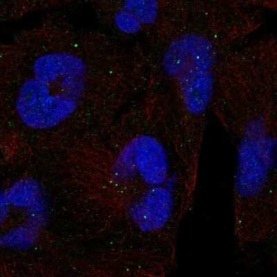 Immunocytochemistry/Immunofluorescence: Clathrin Heavy Chain 2/CHC22/CLTCL1 Antibody [NBP2-56534] - Staining of human cell line RH-30 shows localization to vesicles.