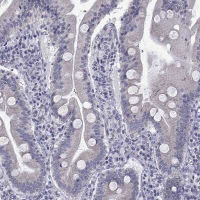 Immunohistochemistry-Paraffin: Clathrin Heavy Chain 2/CHC22/CLTCL1 Antibody [NBP3-17077] - Staining of human small intestine shows low expression as expected.