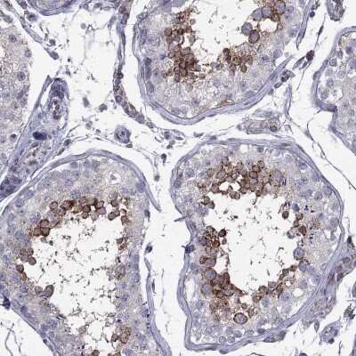 Immunohistochemistry-Paraffin: Clathrin Heavy Chain 2/CHC22/CLTCL1 Antibody [NBP3-17077] - Staining of human testis shows high expression.
