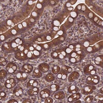 <b>Independent Antibodies Validation. </b>Immunohistochemistry: Clathrin interactor 1 Antibody [NBP2-49239] - Staining of human duodenum shows strong cytoplasmic positivity in glandular cells.