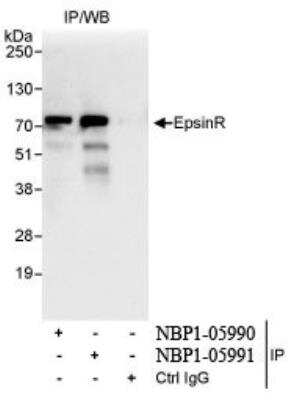 Immunoprecipitation: Clathrin interactor 1 Antibody [NBP1-05990] - Whole cell lysate (1 mg for IP,  20% of IP loaded) from HeLa cells. Antibodies: Affinity purified  rabbit anti-EpsinR antibody used for IP at 3 mcg/mg  lysate.