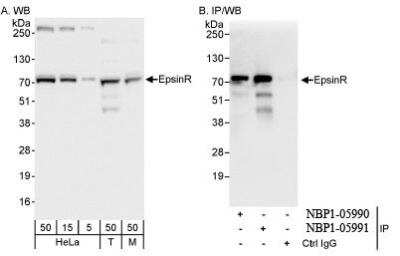 Western Blot: Clathrin interactor 1 Antibody [NBP1-05991] - Whole cell  lysate from HeLa, 293T, and mouse NIH3T3 cells. EpsinR was also  immunoprecipitated by rabbit anti-EpsinR antibody NBP1-05990.