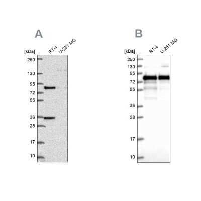 Western Blot: Clathrin interactor 1 Antibody [NBP2-49239] - Analysis using Anti-CLINT1 antibody NBP2-49239 (A) shows similar pattern to independent antibody NBP1-85570 (B).