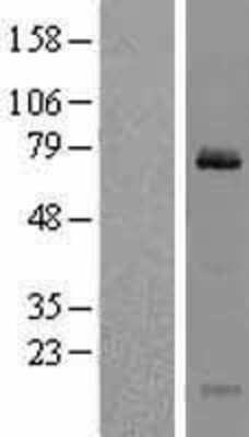 Western Blot: Clathrin interactor 1 Overexpression Lysate (Adult Normal) [NBL1-09271] Left-Empty vector transfected control cell lysate (HEK293 cell lysate); Right -Over-expression Lysate for Clathrin interactor 1.