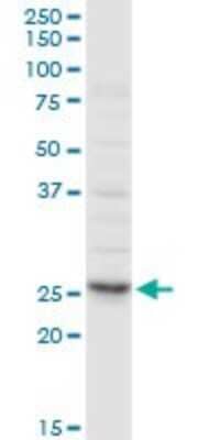 Western Blot: Clathrin light chain Antibody [H00001211-D01P] - Analysis of CLTA expression in HeLa.