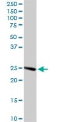 Western Blot: Clathrin light chain Antibody [H00001211-D01P] - Analysis of CLTA expression in mouse kidney.