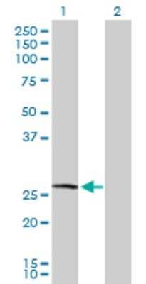 Western Blot: Clathrin light chain Antibody [H00001211-D01P] - Analysis of CLTA expression in transfected 293T cell line by CLTA polyclonal antibody.Lane 1: CLTA transfected lysate(23.70 KDa).Lane 2: Non-transfected lysate.