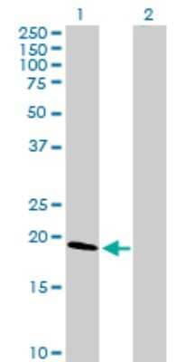 Western Blot: Claudin-1 Antibody [H00009076-D01P] - Analysis of CLDN1 expression in transfected 293T cell line by CLDN1 polyclonal antibody.Lane 1: CLDN1 transfected lysate(22.70 KDa).Lane 2: Non-transfected lysate.