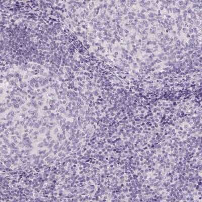 <b>Orthogonal Strategies Validation. </b>Immunohistochemistry-Paraffin: Claudin 10 Antibody [NBP2-38495] - Staining of human lymph node shows low expression as expected.