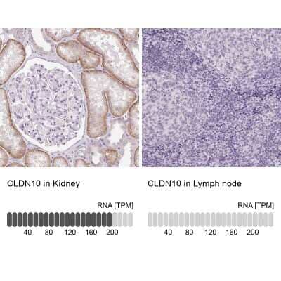 Immunohistochemistry-Paraffin: Claudin 10 Antibody [NBP2-38495] - Staining in human kidney and lymph node tissues using anti-CLDN10 antibody. Corresponding CLDN10 RNA-seq data are presented for the same tissues.