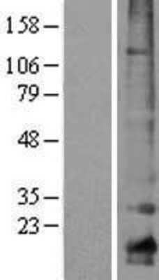 Western Blot: Claudin 10 Overexpression Lysate (Adult Normal) [NBP2-04323] Left-Empty vector transfected control cell lysate (HEK293 cell lysate); Right -Over-expression Lysate for Claudin 10.