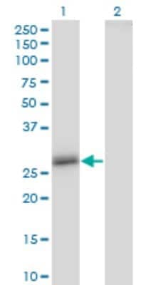 Western Blot: Claudin-16 Antibody (1F2) [H00010686-M02] - Analysis of CLDN16 expression in transfected 293T cell line by CLDN16 monoclonal antibody (M02), clone 1F2.Lane 1: CLDN16 transfected lysate(33.8 KDa).Lane 2: Non-transfected lysate.