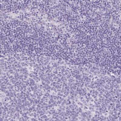 Immunohistochemistry-Paraffin: Claudin-16 Antibody [NBP2-38777] - Staining of human lymph node shows low expression as expected.