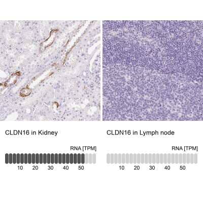 <b>Orthogonal Strategies Validation. </b>Immunohistochemistry-Paraffin: Claudin-16 Antibody [NBP2-38777] - Staining in human kidney and lymph node tissues using anti-CLDN16 antibody. Corresponding CLDN16 RNA-seq data are presented for the same tissues.