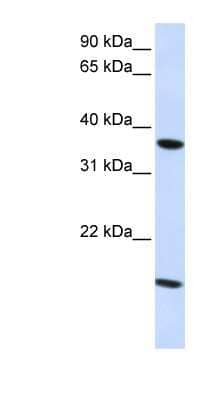 Western Blot: Claudin 16 Antibody [NBP1-59105] - Human Fetal kidney Lysate, concentration 1.25 ug/ml.