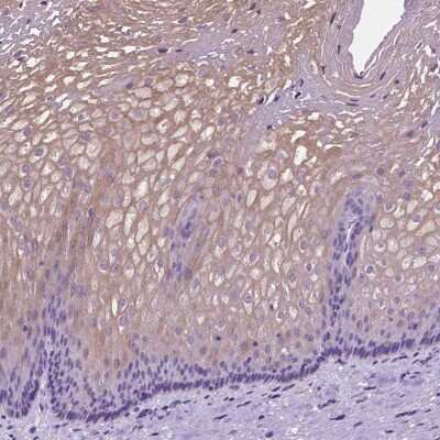 Immunohistochemistry-Paraffin: Claudin-17 Antibody [NBP2-48838] - Staining of human esophagus shows high expression.