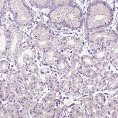 Immunohistochemistry-Paraffin: Claudin-17 Antibody [NBP2-48838] - Staining of human stomach shows low expression as expected.