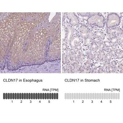<b>Orthogonal Strategies Validation. </b>Immunohistochemistry-Paraffin: Claudin-17 Antibody [NBP2-48838] - Staining in human esophagus and stomach tissues using anti-CLDN17 antibody. Corresponding CLDN17 RNA-seq data are presented for the same tissues.