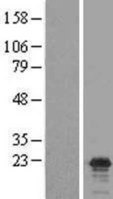 Western Blot: Claudin 17 Overexpression Lysate (Adult Normal) [NBL1-09242] Left-Empty vector transfected control cell lysate (HEK293 cell lysate); Right -Over-expression Lysate for Claudin 17.